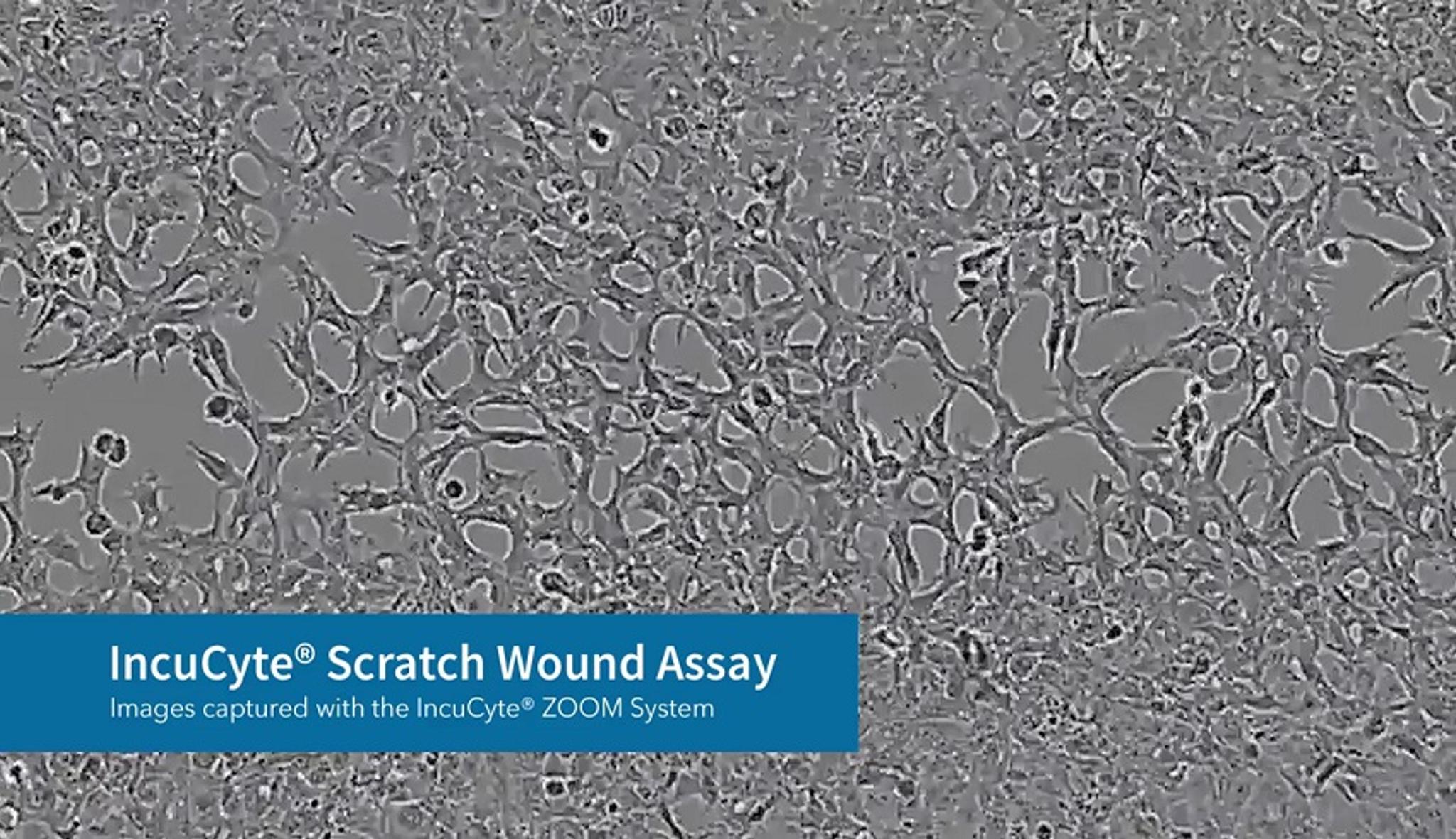 Incucyte® Scratch Wound Cell Invasion & Migration Software | SelectScience