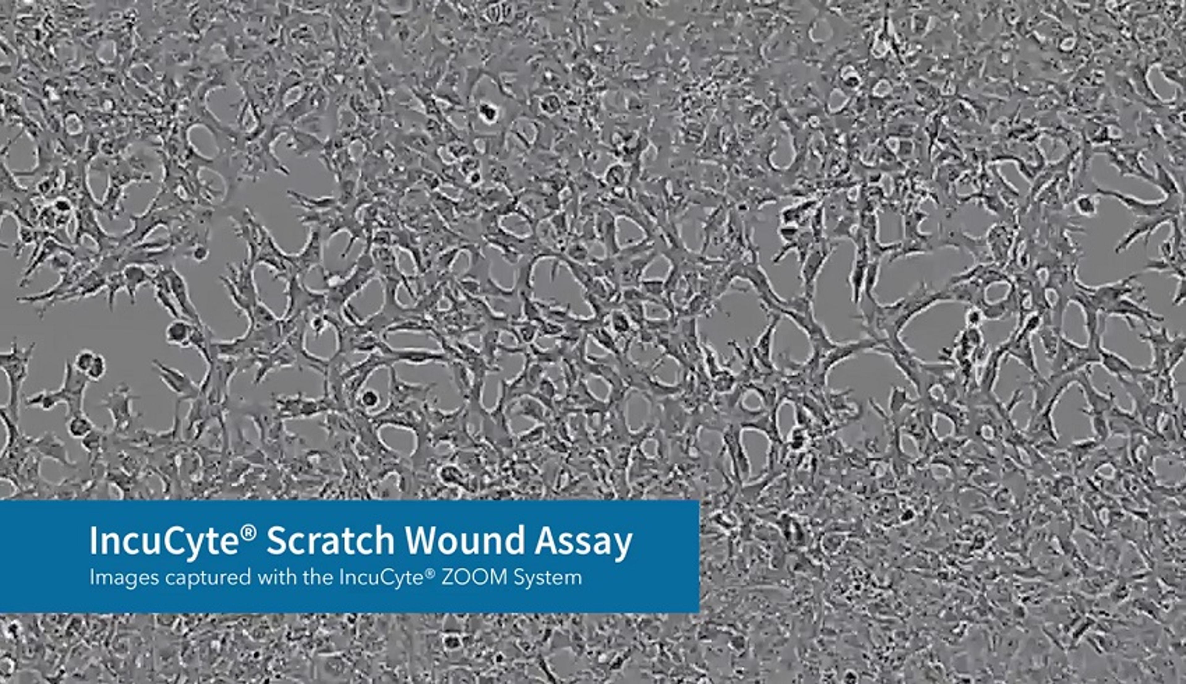 IncuCyte® Scratch Wound Assay IncuCyte® Scratch Wound Assay