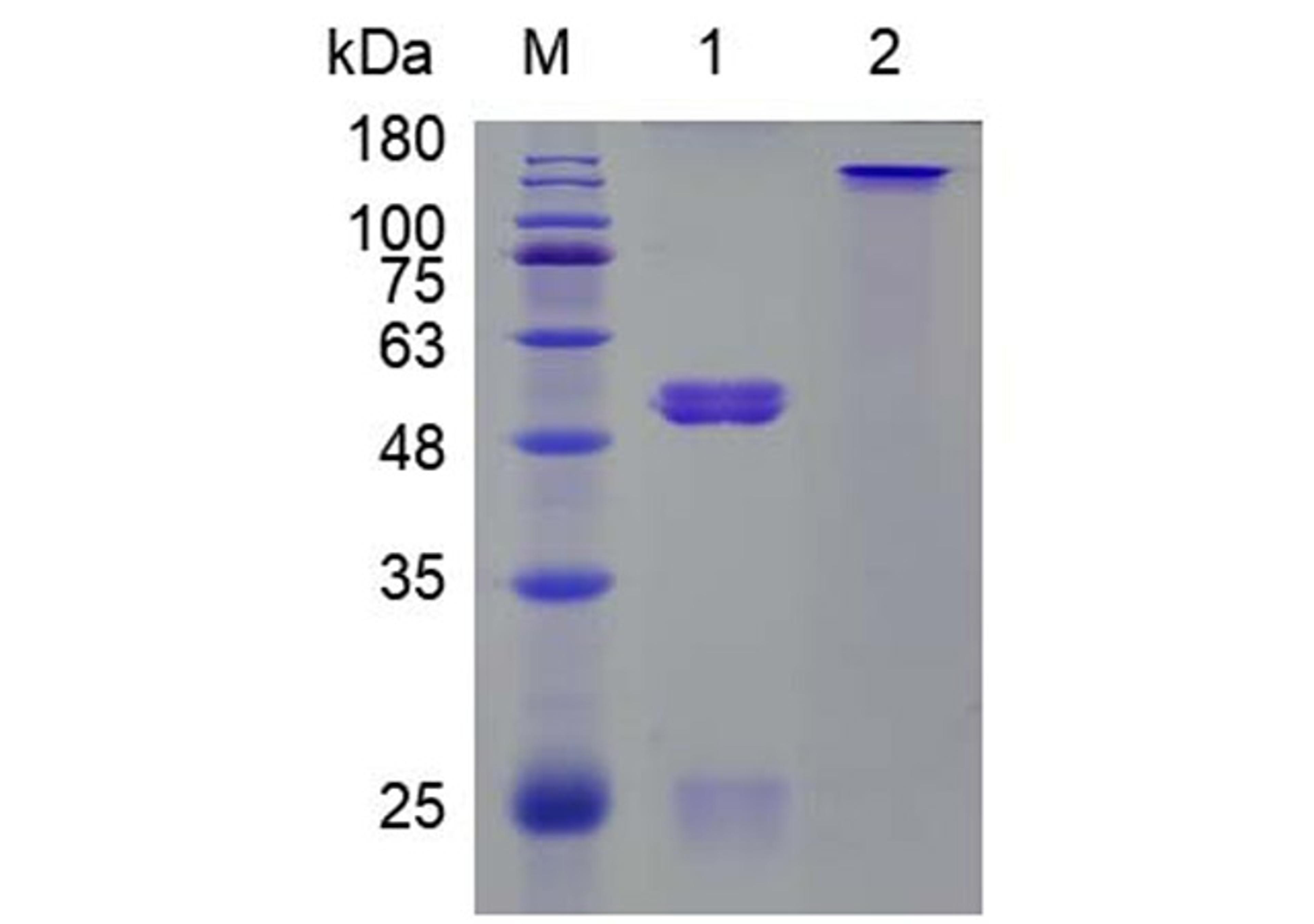 Rabbit Anti-Hypusine Recombinant Antibody (PABL-202)