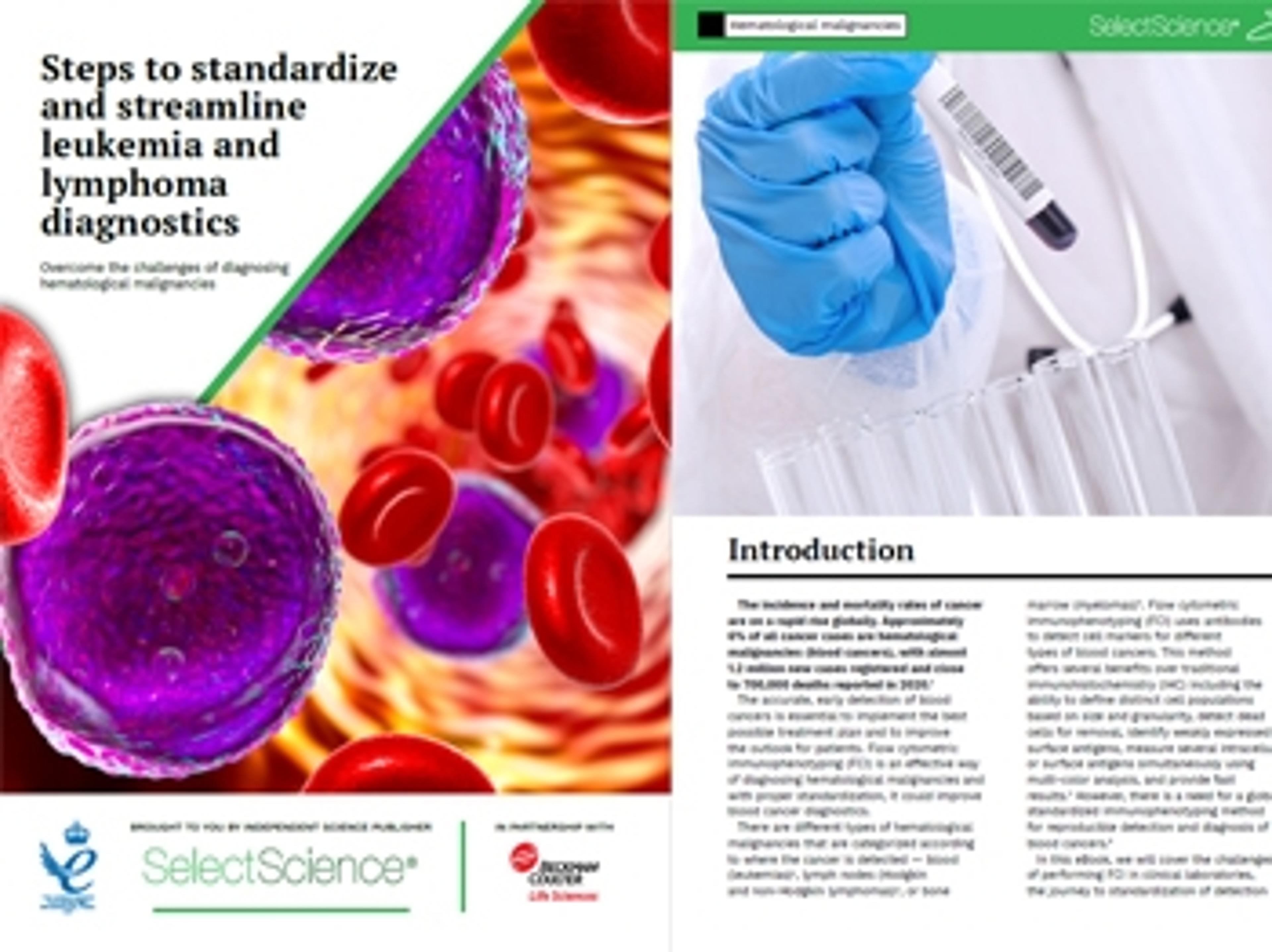 Steps to standardize and streamline leukemia and lymphoma diagnostics