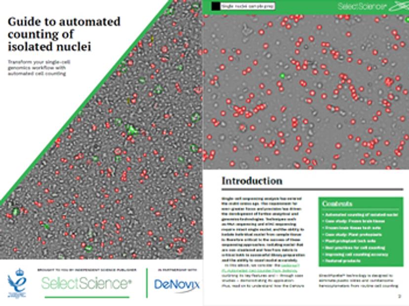 Organoids: Overcome the challenges of high-throughput 3D imaging and analysis eBook preview