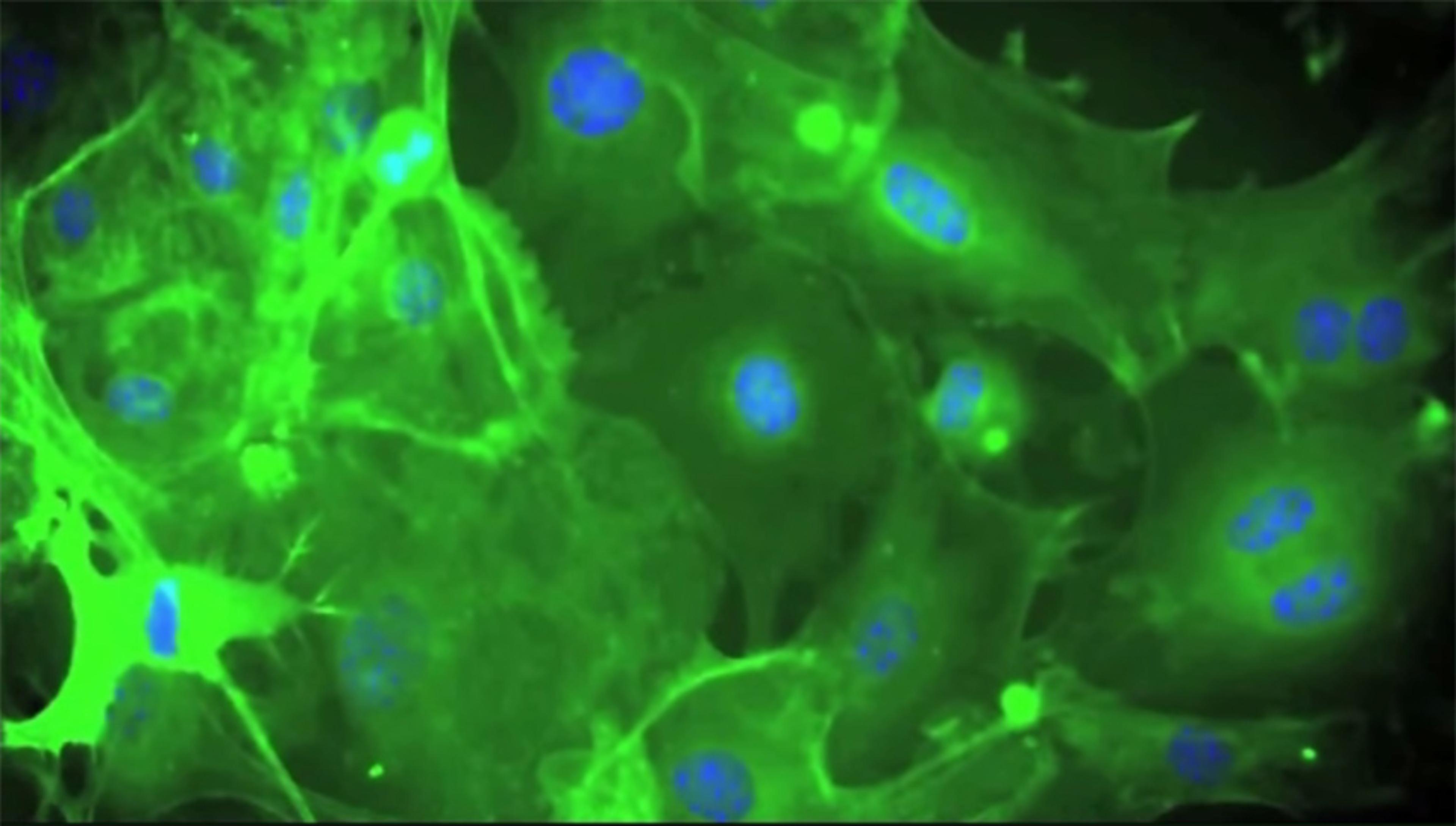 Detect Your Unseen Protein Detect Your Unseen Protein