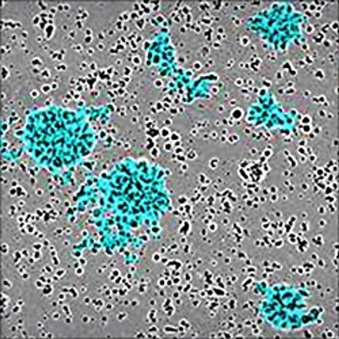 Label-free detection of T cell aggregation.