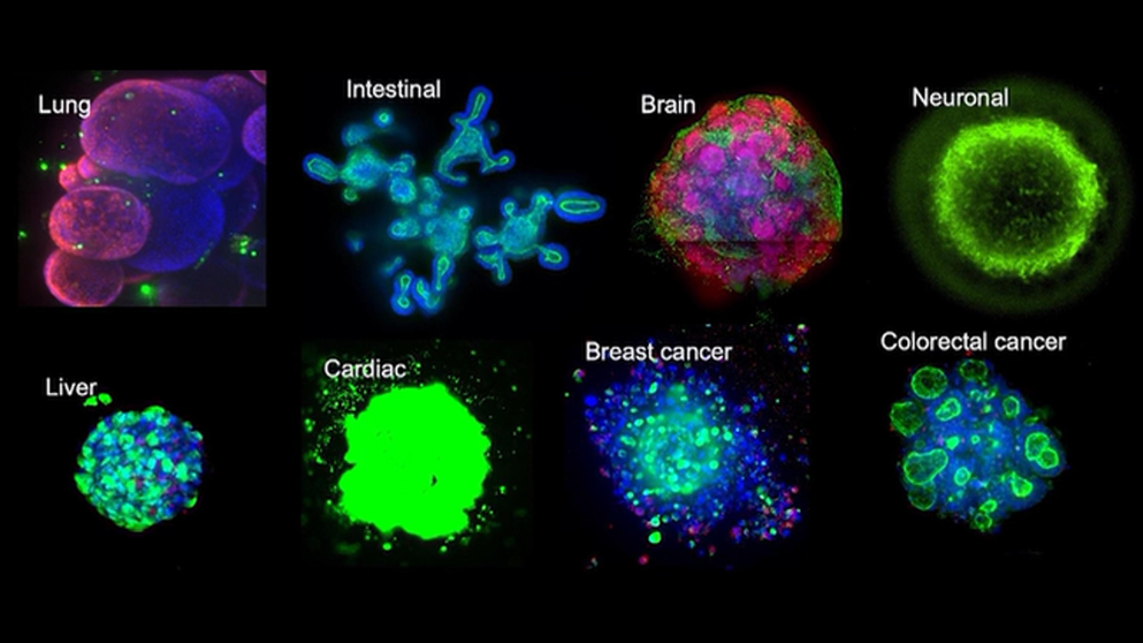 CellXpress.ai Automated Cell Culture System transforms cardiovascular research CellXpress.ai Automated Cell Culture System transforms cardiovascular research