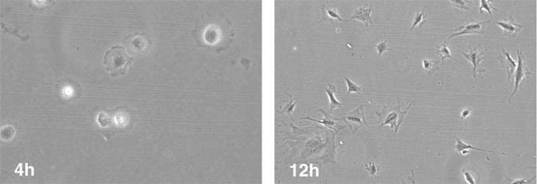 Appearance of the murine osteocyte-like cell line.