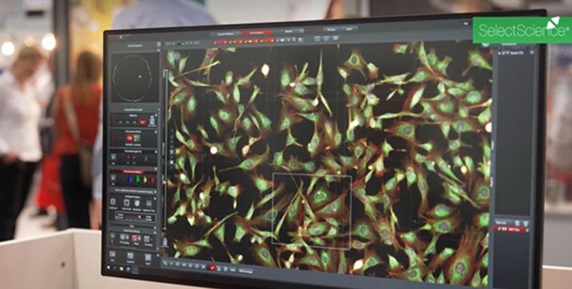 A computer screen showing an image of cells being analyzed with Microhub software.