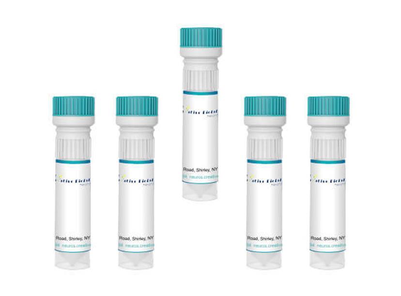 Creative Biolabs Biospecimens