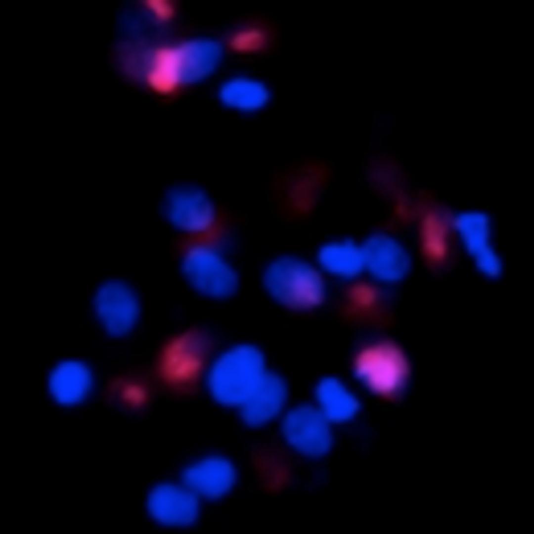 Imaging cell health. Etoposide: DRAQ7/Hoechst