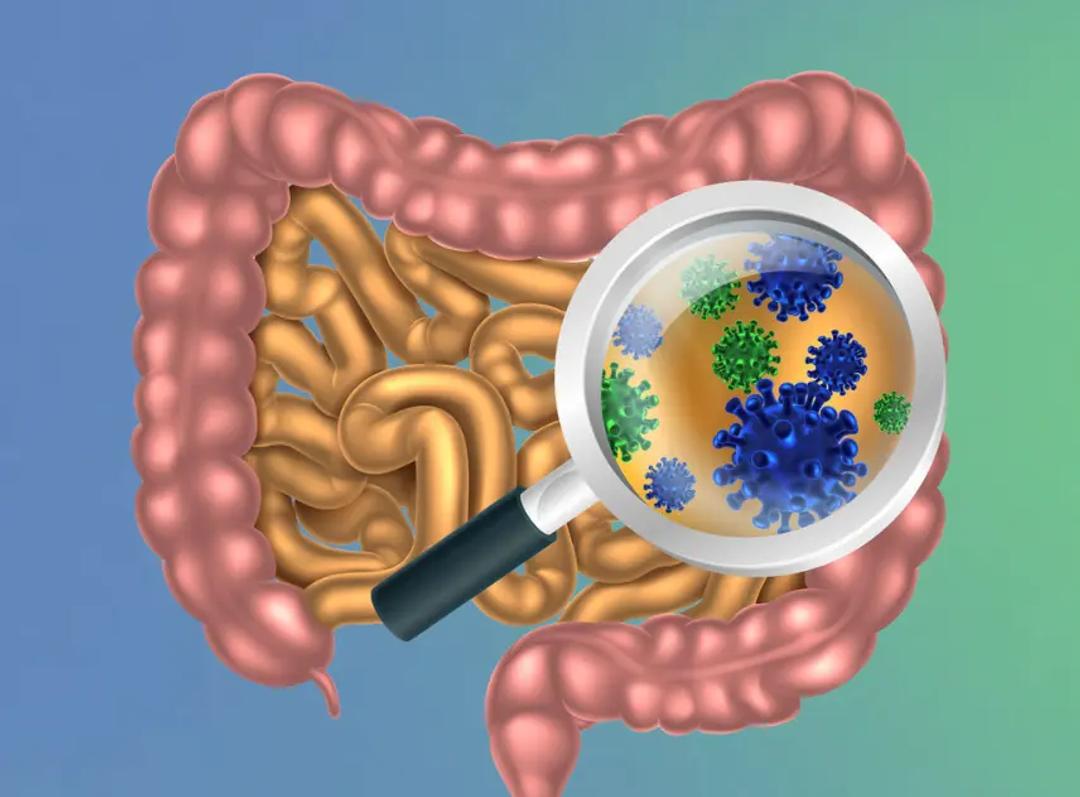 Syndromic testing to advance gastroenteritis diagnosis