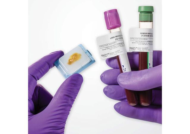 Bio-Plex Pro™ Human Cytokine 27-plex Assay | SelectScience