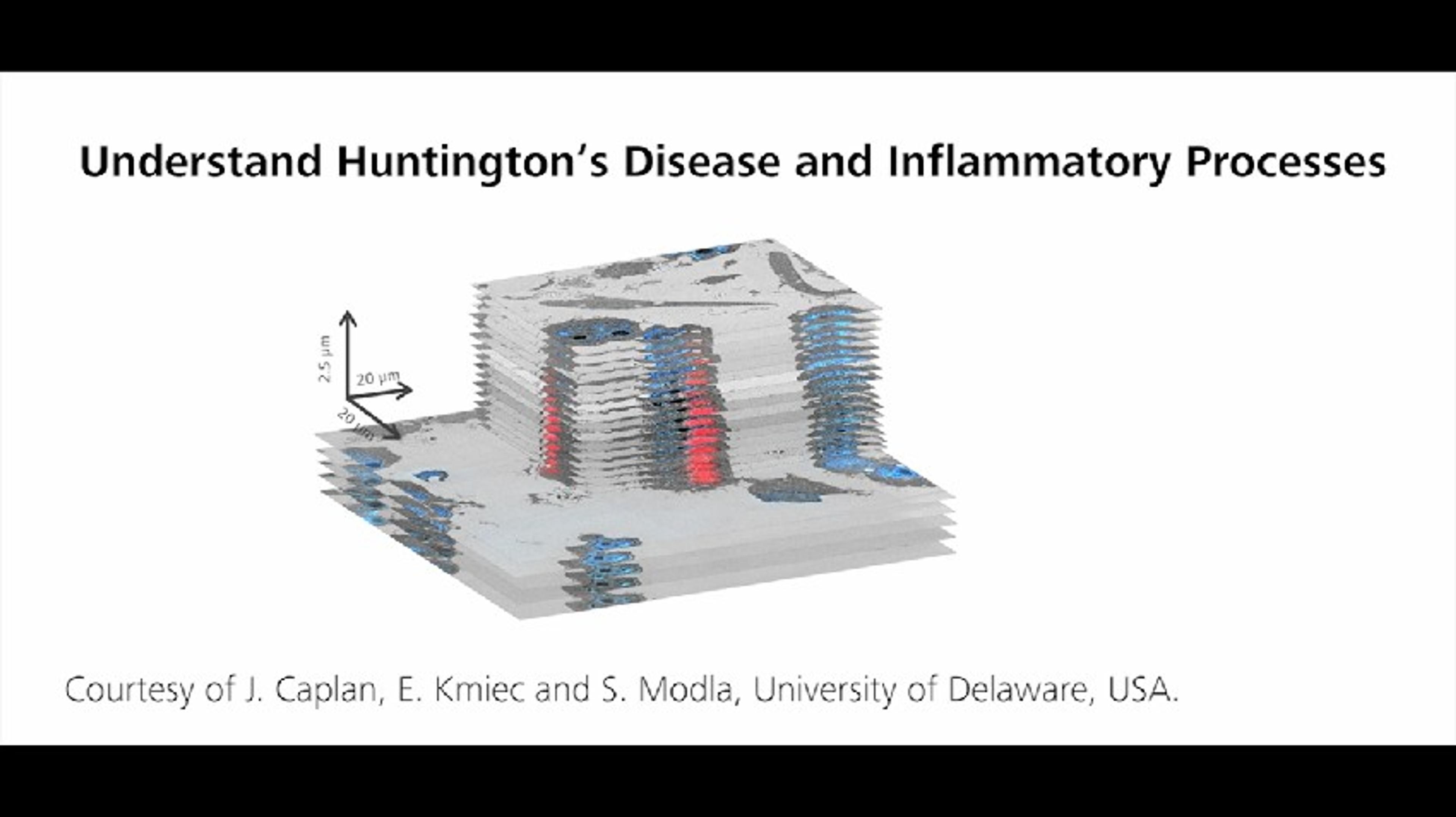 ZEISS ZEN Correlative Array Tomography: Understanding Huntington's Disease ZEISS ZEN Correlative Array Tomography: Understanding Huntington's Disease