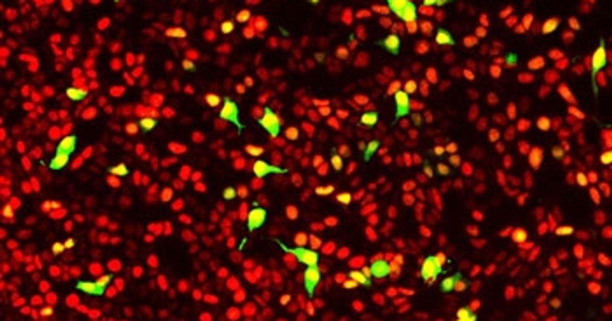 Fluorescent Biosensors Reveal the Inner Workings of Living Cells