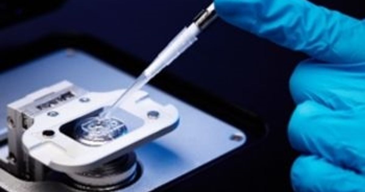 Comparison of analytical approaches for AAV characterization