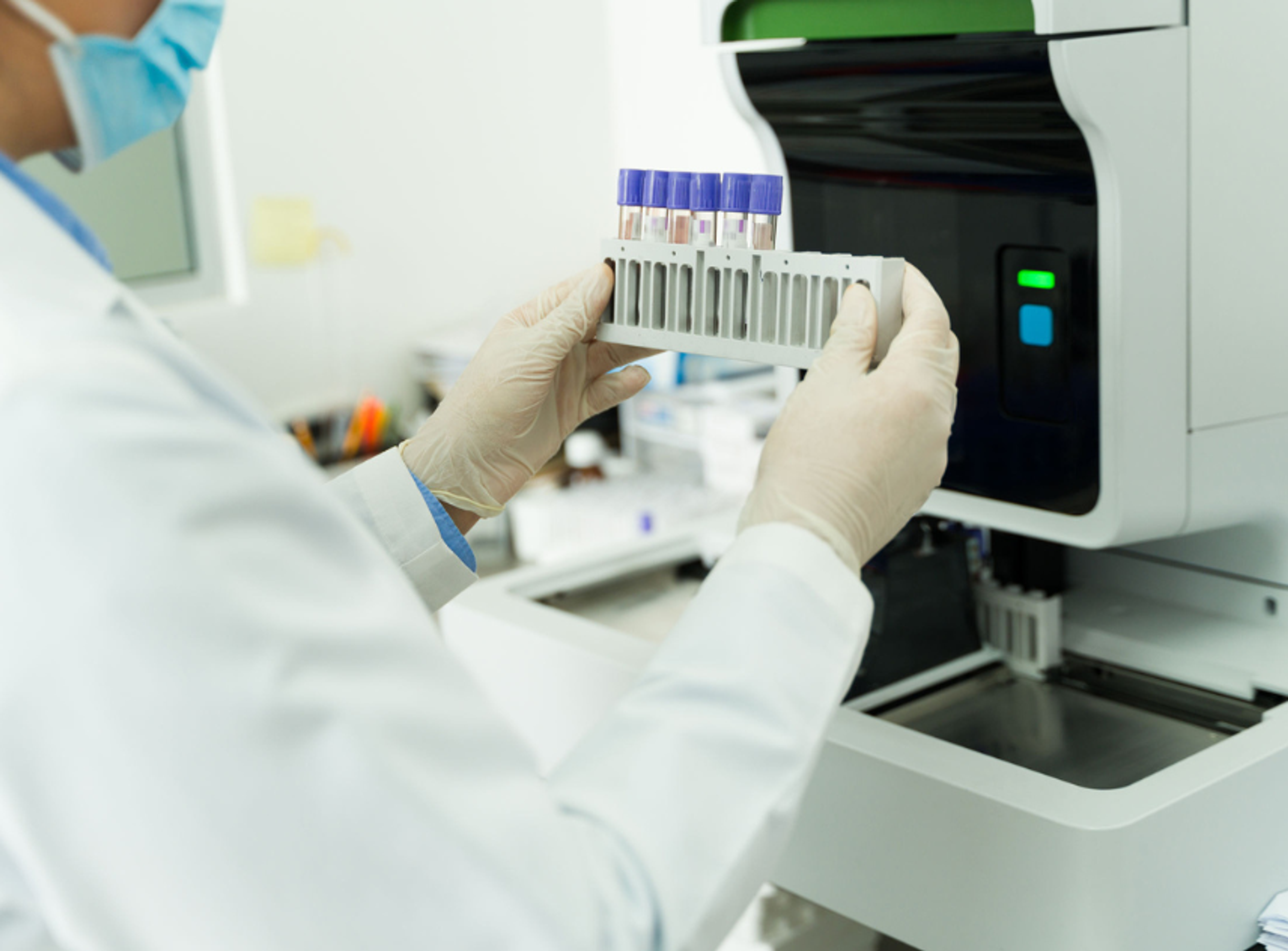 Image of sample tubes in a rack about to be placed in an automated clinical analyzer