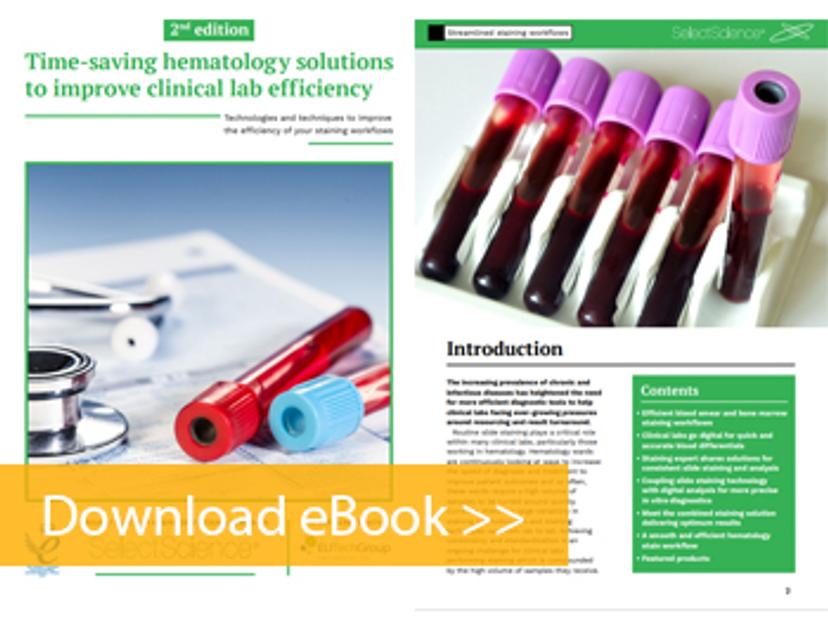 Time-saving hematology staining solutions eBook front cover and first page preview