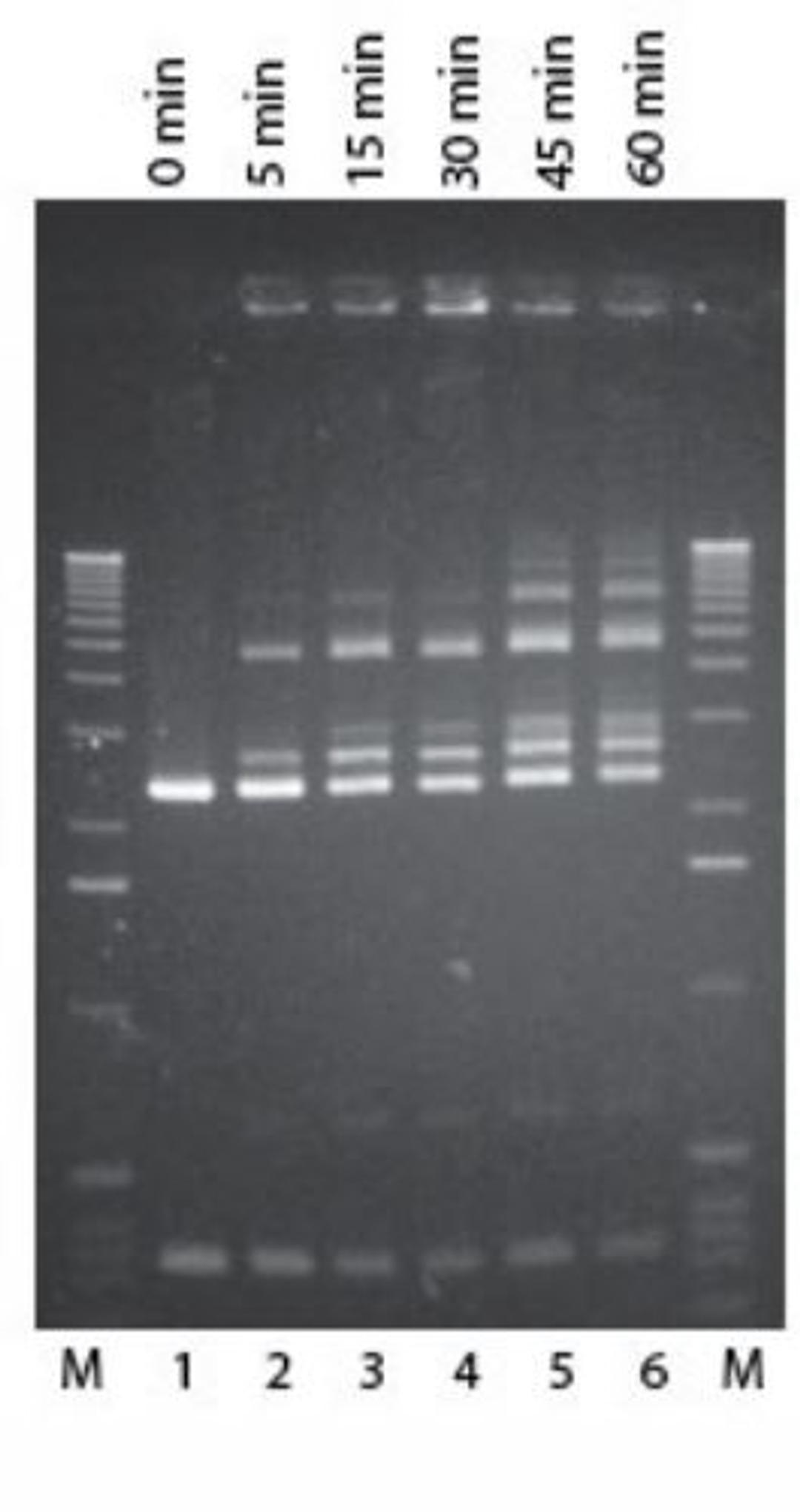 cohesive end ligation