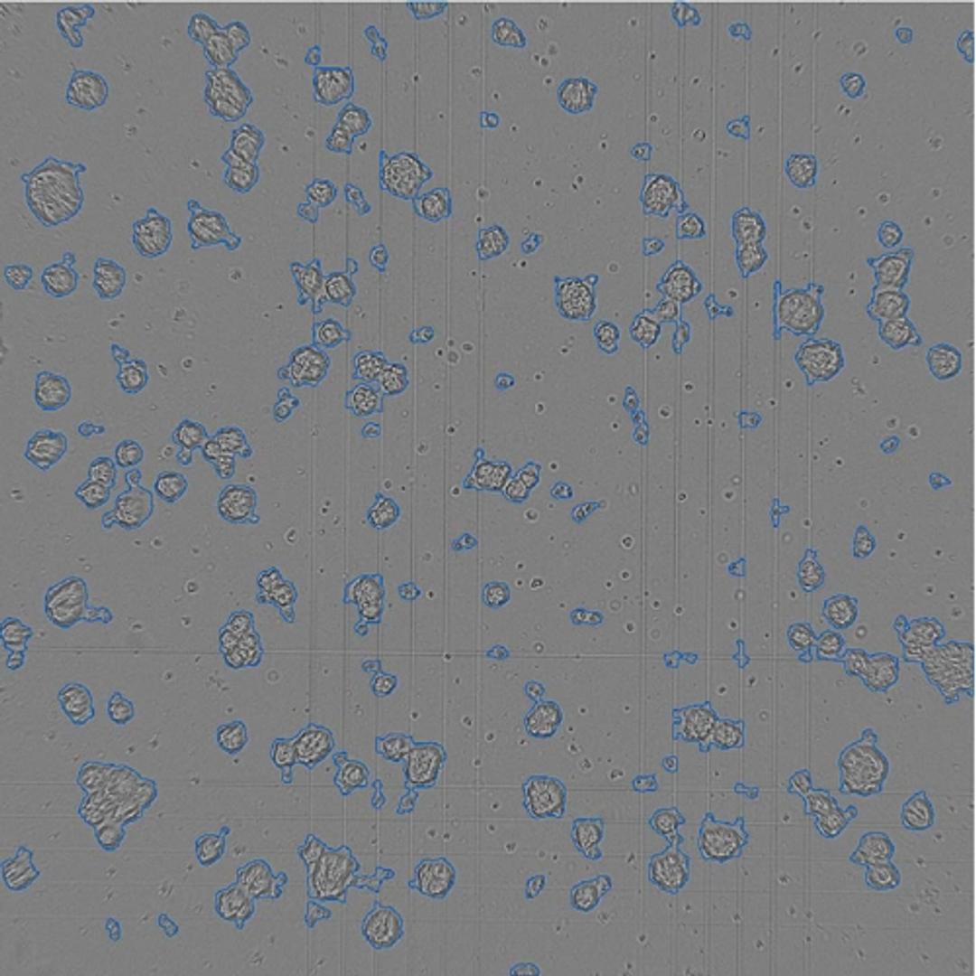 Image analysis algorithm optimized for organoid detection