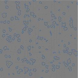 Image analysis algorithm optimized for organoid detection