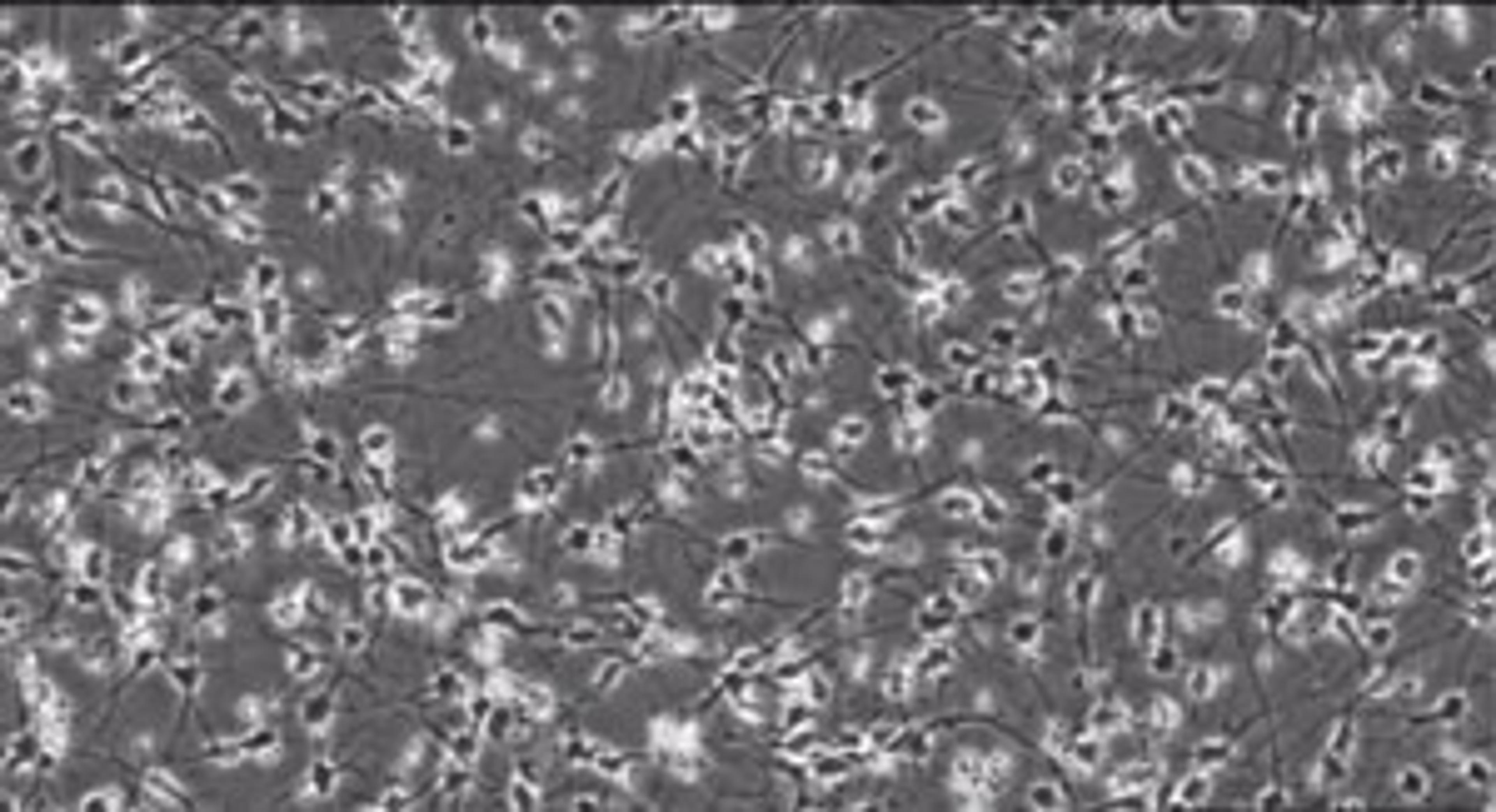 Cellular Dynamics: 28 Day Time-lapse of Neurite Outgrowth of iCell® Neurons Cellular Dynamics: 28 Day Time-lapse of Neurite Outgrowth of iCell® Neurons
