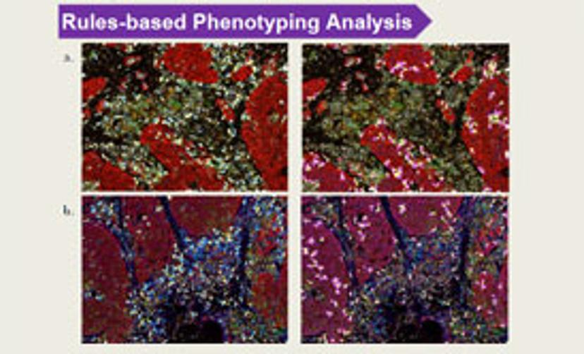 Brendan Brinkman from Olympus - SelectScience Webinar - precision medicine special feature