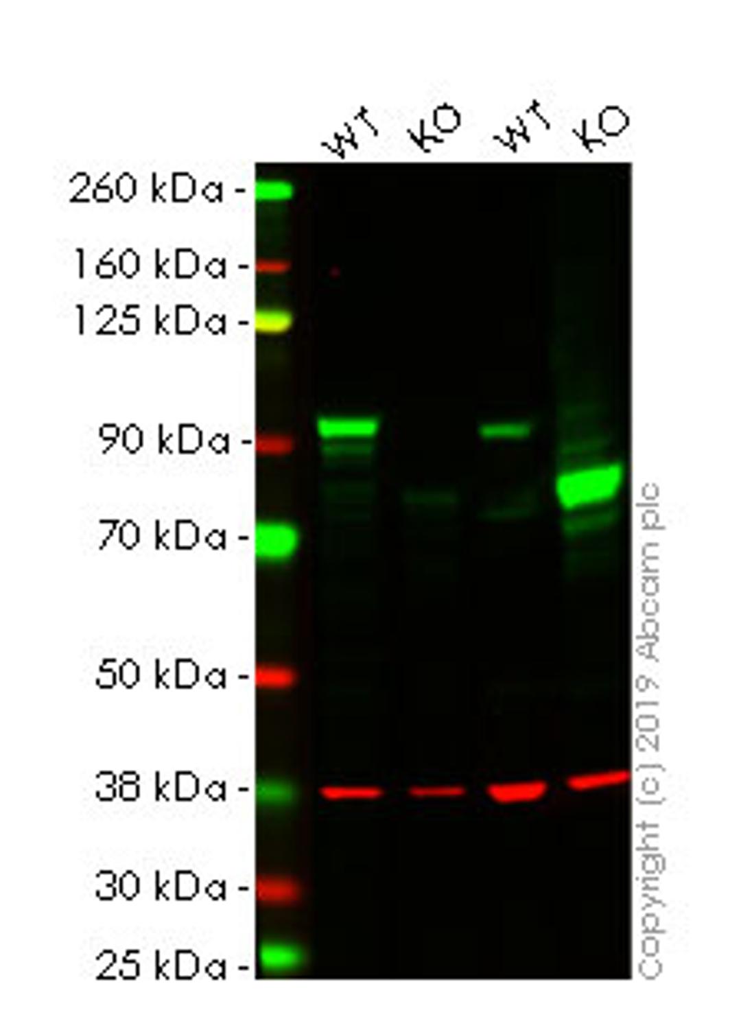 WB - CTNNB1 knockout HeLa