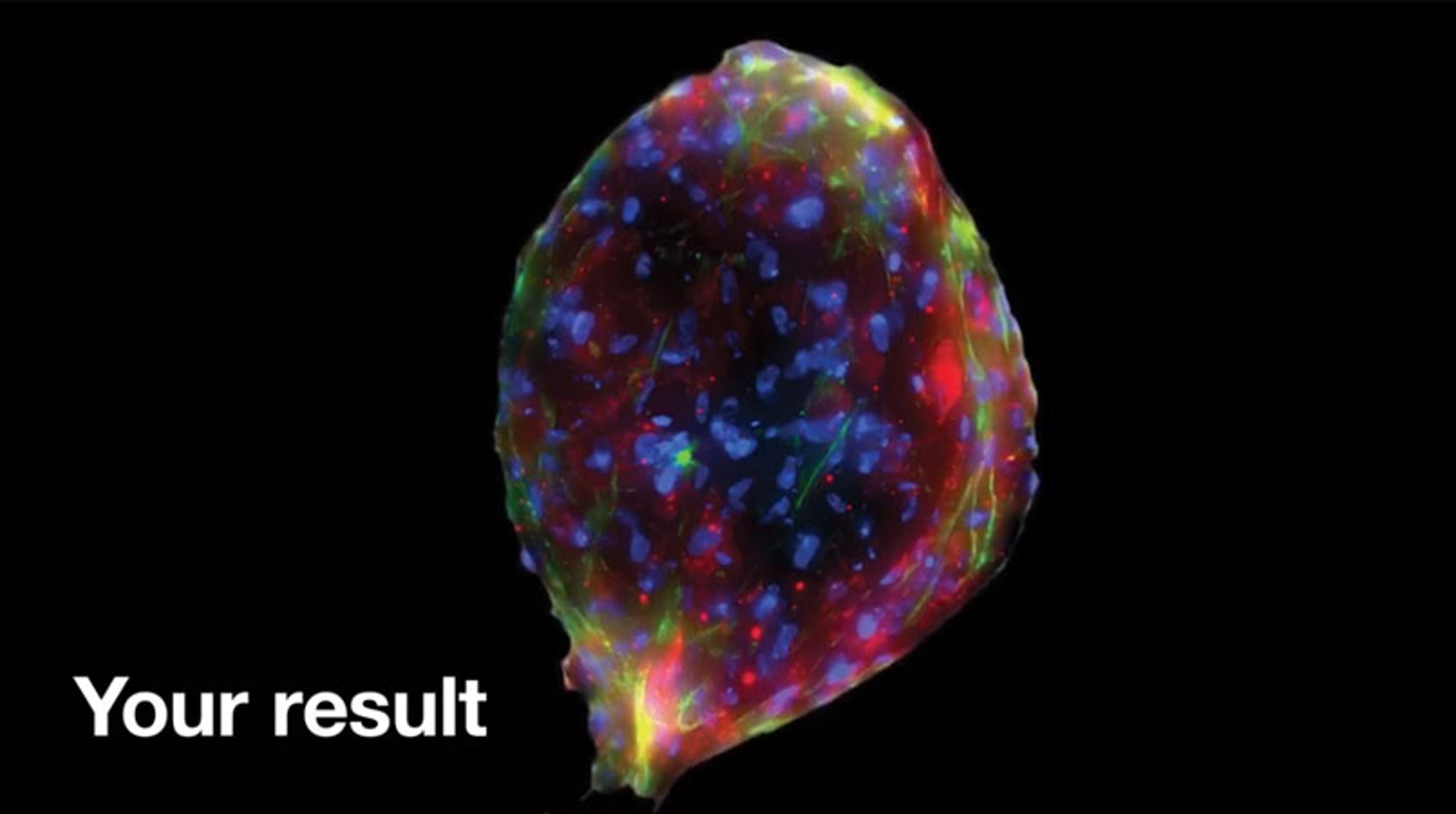 Magnetic 3D Bioprinting of Spheroids Magnetic 3D Bioprinting of Spheroids