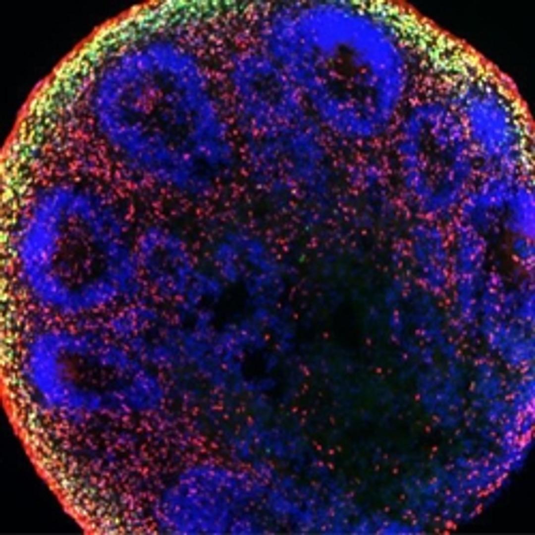 Brain organoid derived from stem cells grown with FGF2 DISCs