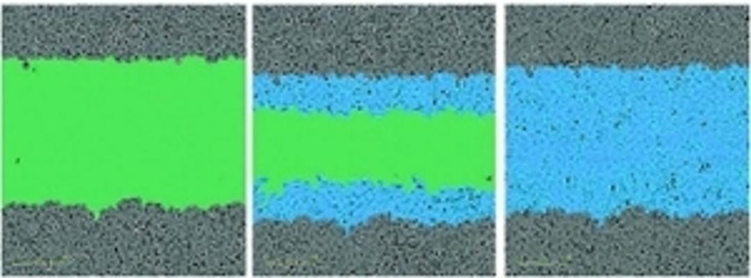 Visualize & analyze wound closure in real time