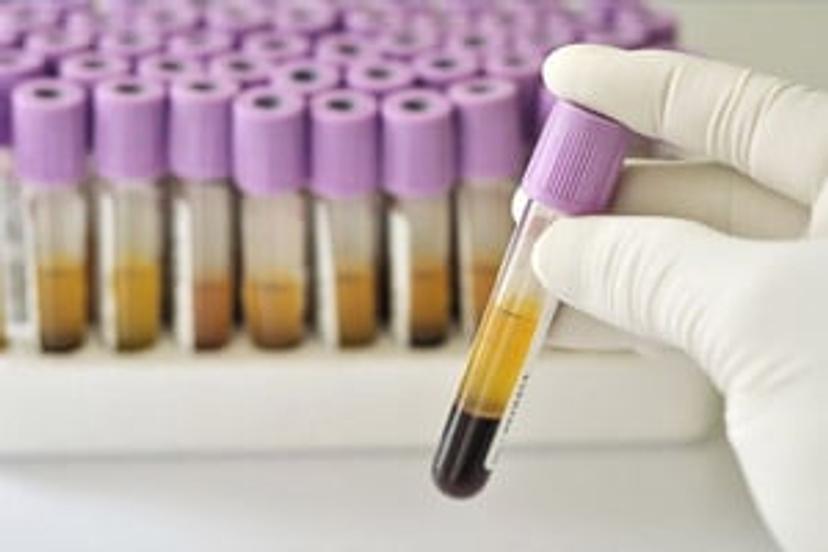 Reacting to epidemic and emerging infectious diseases: QIAGEN's diagnostic and surveillance response to MPXV