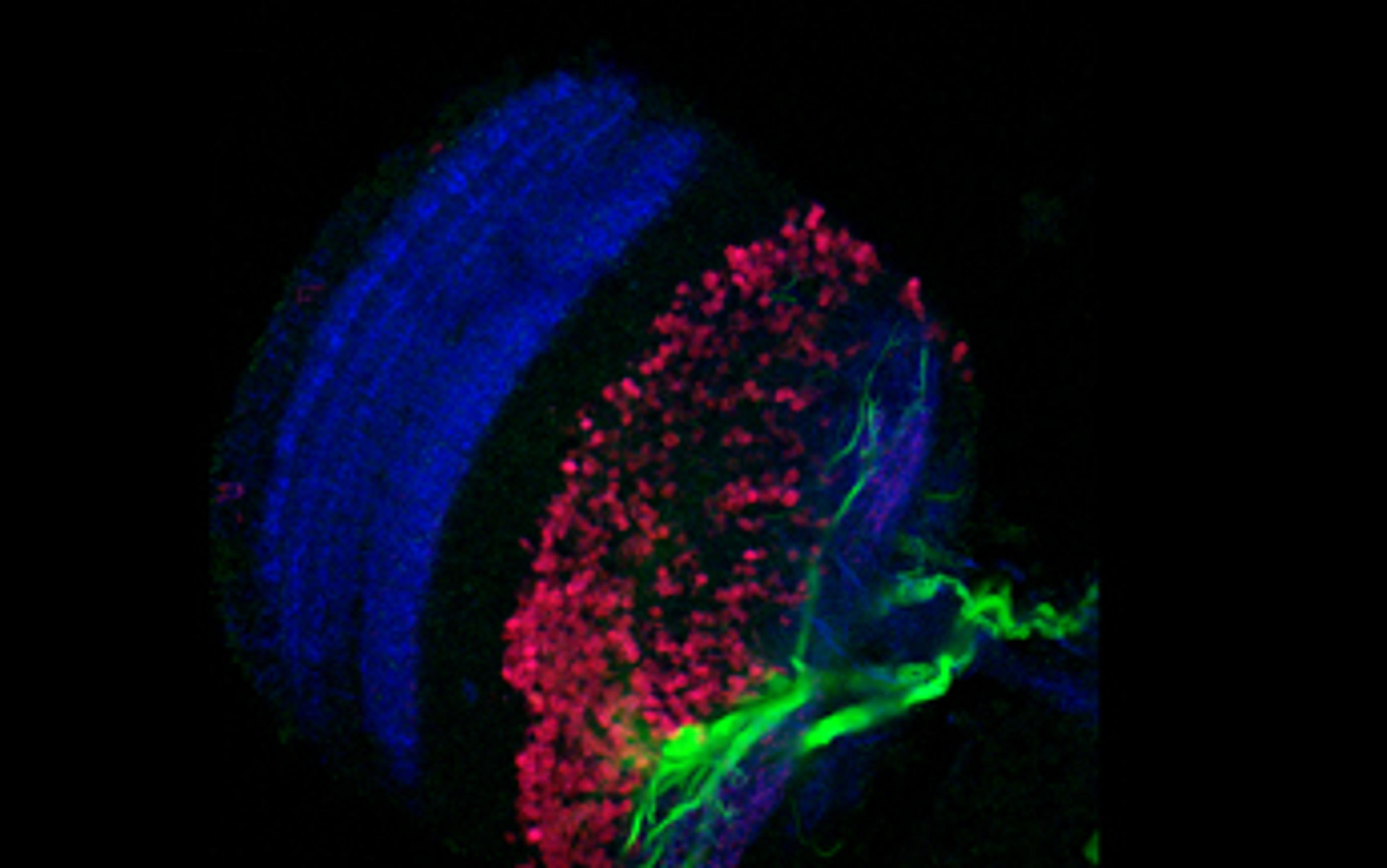 Drosophila Brain Imaging with the ZEISS LSM 800 with Airyscan Drosophila Brain Imaging with the ZEISS LSM 800 with Airyscan