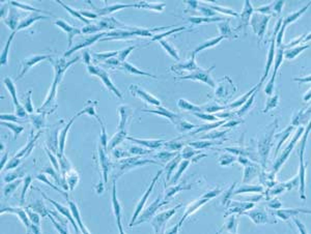 Human Mesenchymal Stem Cells
