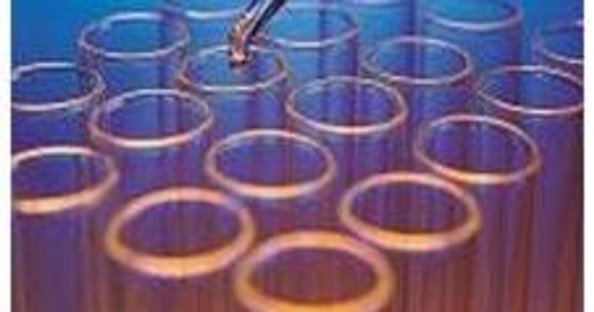 Buy RapidFire Epigenetic Assay Development & Screening Services Read ...