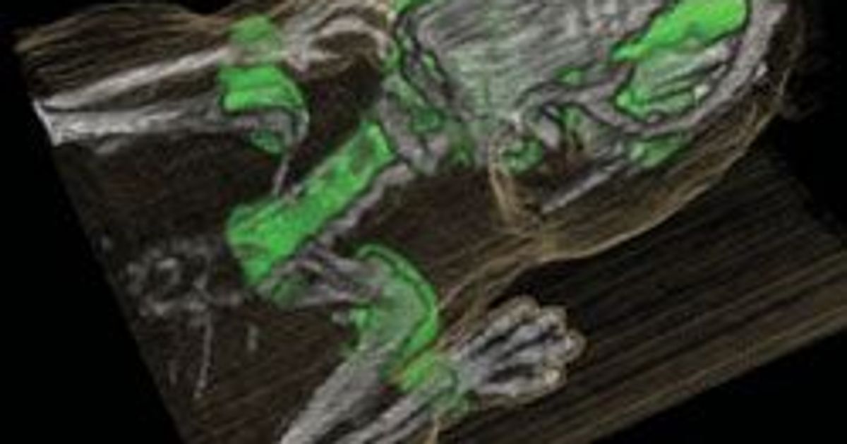 Carestream Molecular Imaging Signs Exclusive Agreement to Provide ...