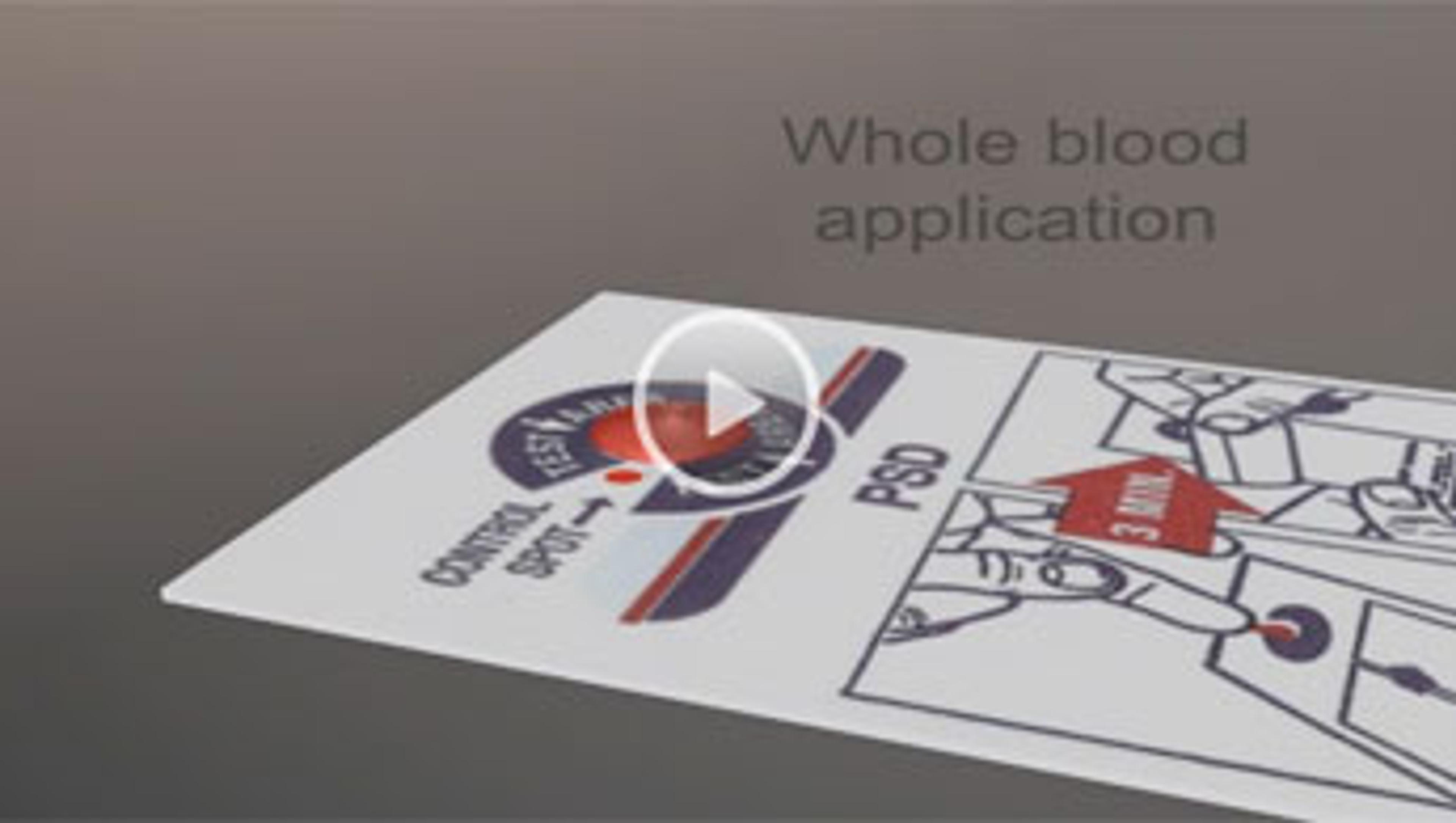Next Generation Dried Sample Spot Technology Next Generation Dried Sample Spot Technology