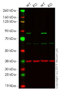 WB - TGM2 knockout HeLa