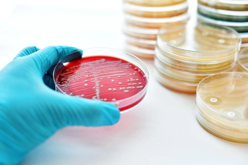 Clinical microbiologists play an essential role in preventing healthcare-associated infections by ensuring early detection