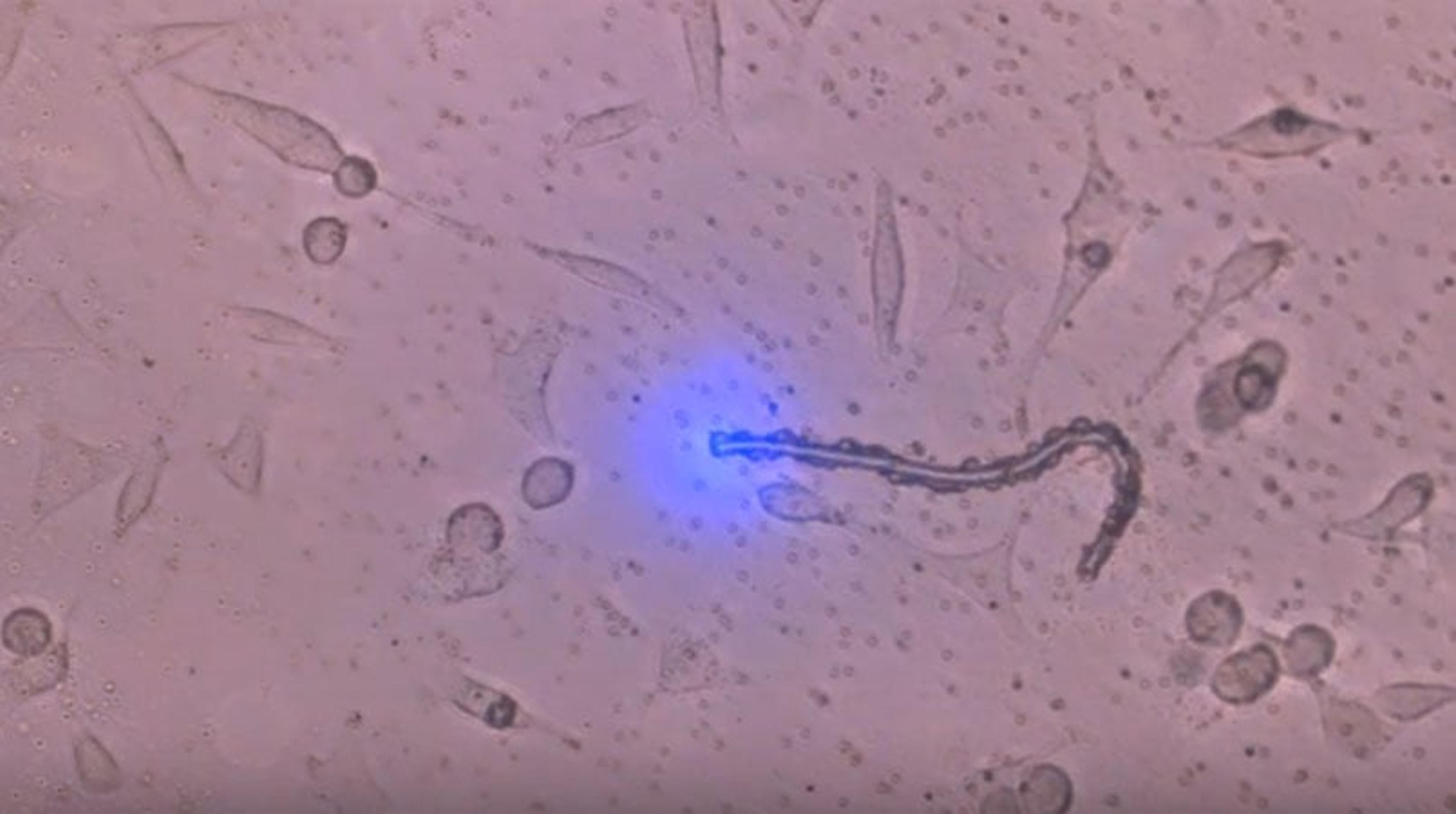 Cutting Living Cells with the MMI CellCut Cutting Living Cells with the MMI CellCut