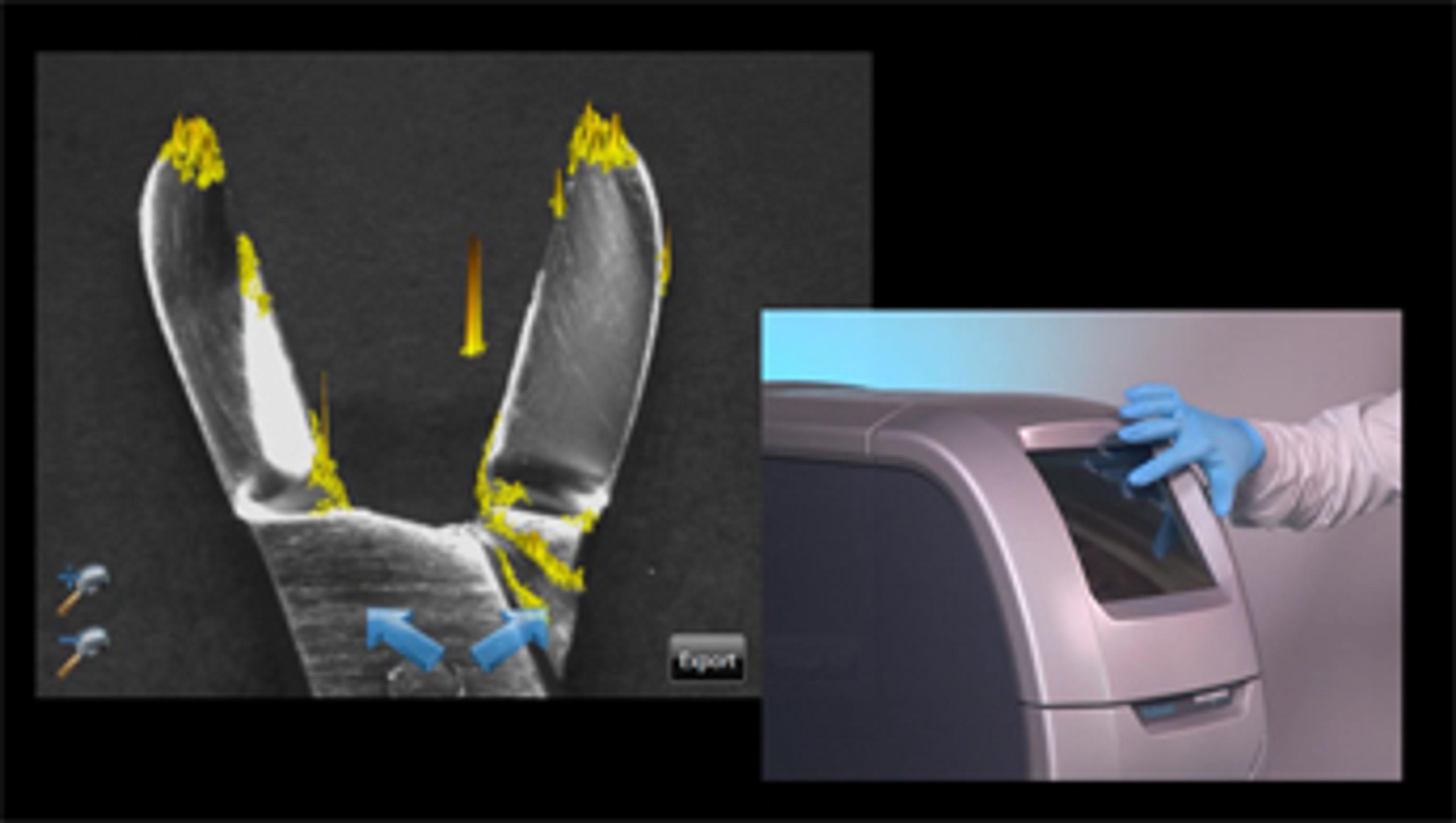 ProReveal from Synoptics Determines the Cleanliness of Surgical Instruments ProReveal from Synoptics Determines the Cleanliness of Surgical Instruments