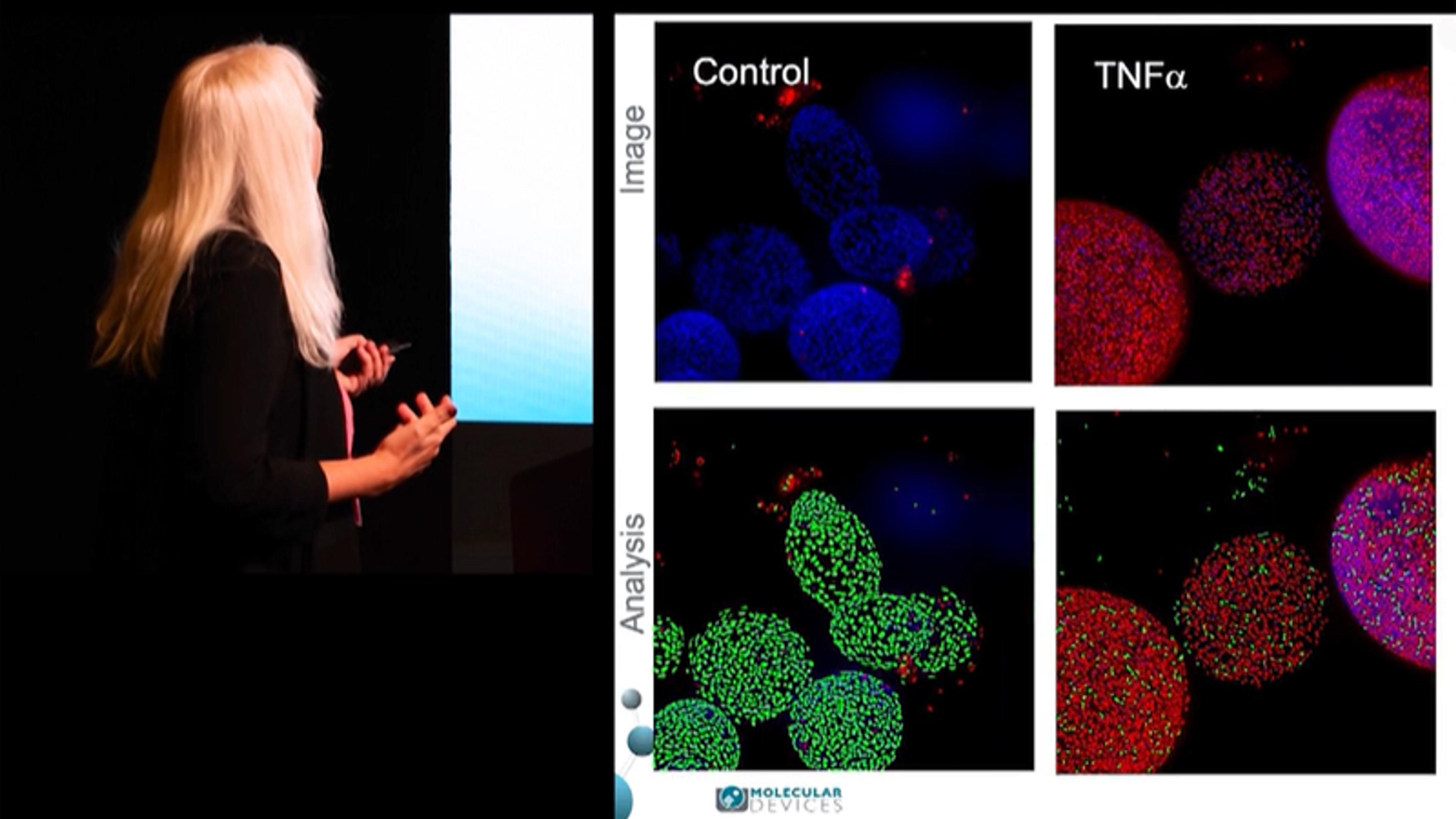 Machine learning powers 3D organoid analysis Machine learning powers 3D organoid analysis