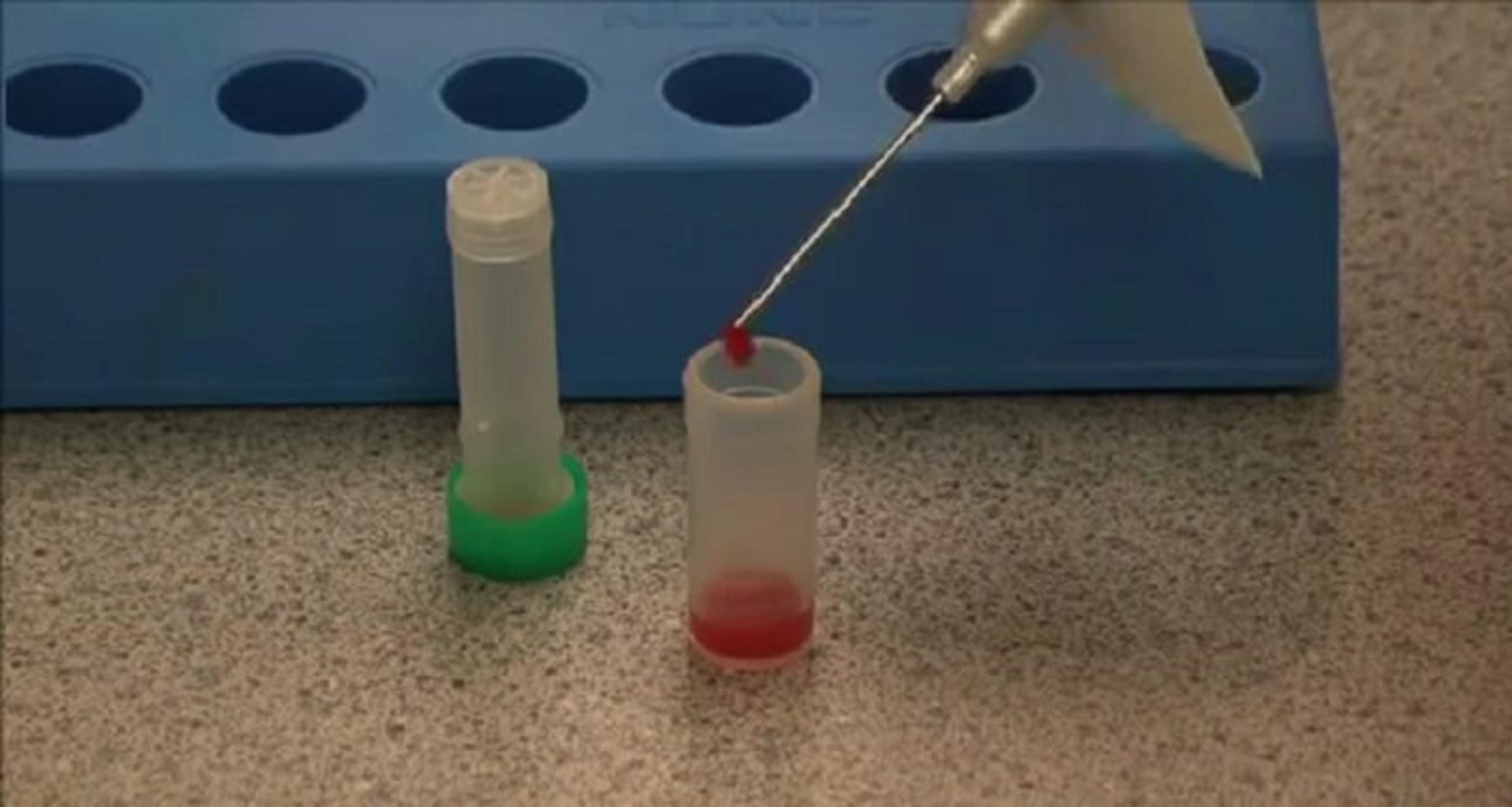 Removing Resin Beads from Blood Culture Before Using QuickFISH Removing Resin Beads from Blood Culture Before Using QuickFISH