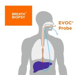 EVOC Probes - Targeted metabolism analysis