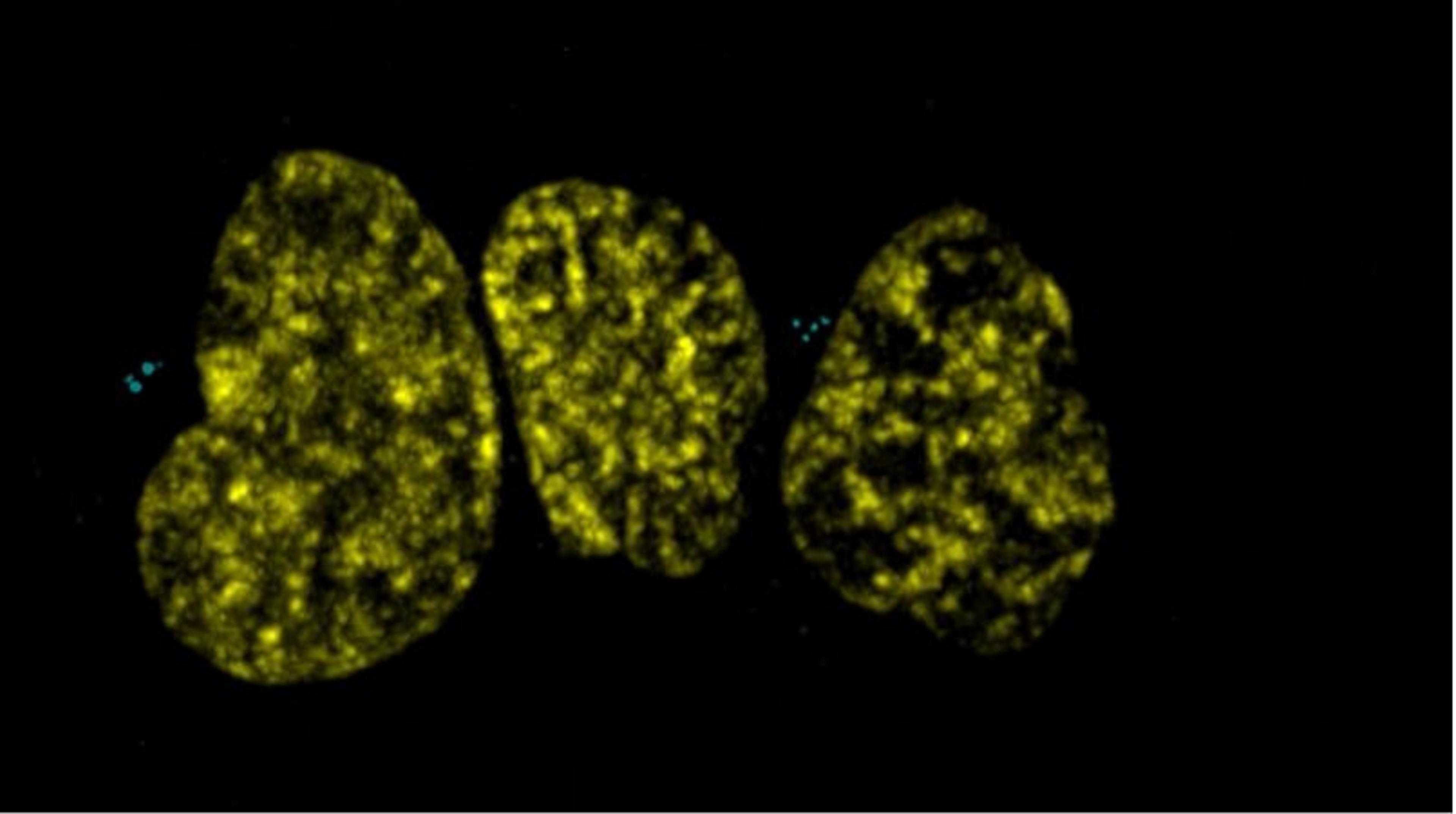 Cell division captured with the X-Light V2 Cell division captured with the X-Light V2