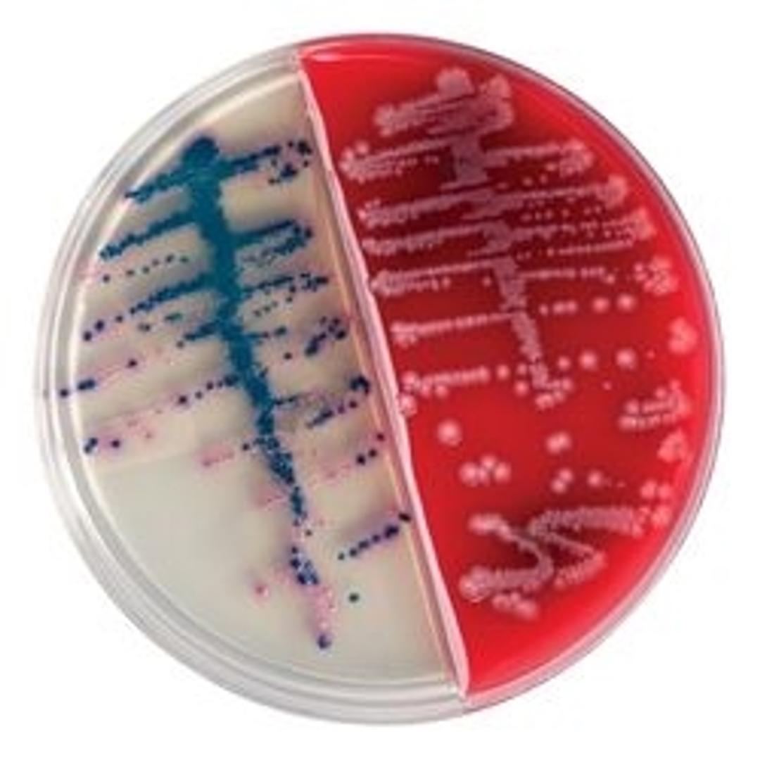 Bi-Plate BD BBL™ CHROMagar™ Orientation/BD BBL™ Trypticase™