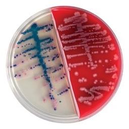 Bi-Plate BD BBL™ CHROMagar™ Orientation/BD BBL™ Trypticase™