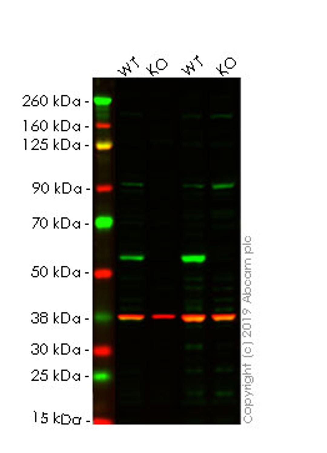 WB - SQSTM1 knockout HEK293T