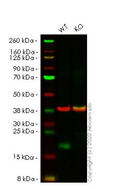 WB - EIF4EBP1 knockout HeLa