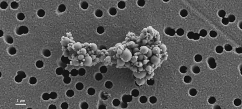 An SEM image of a microplastic particle is used in microplastics analysis