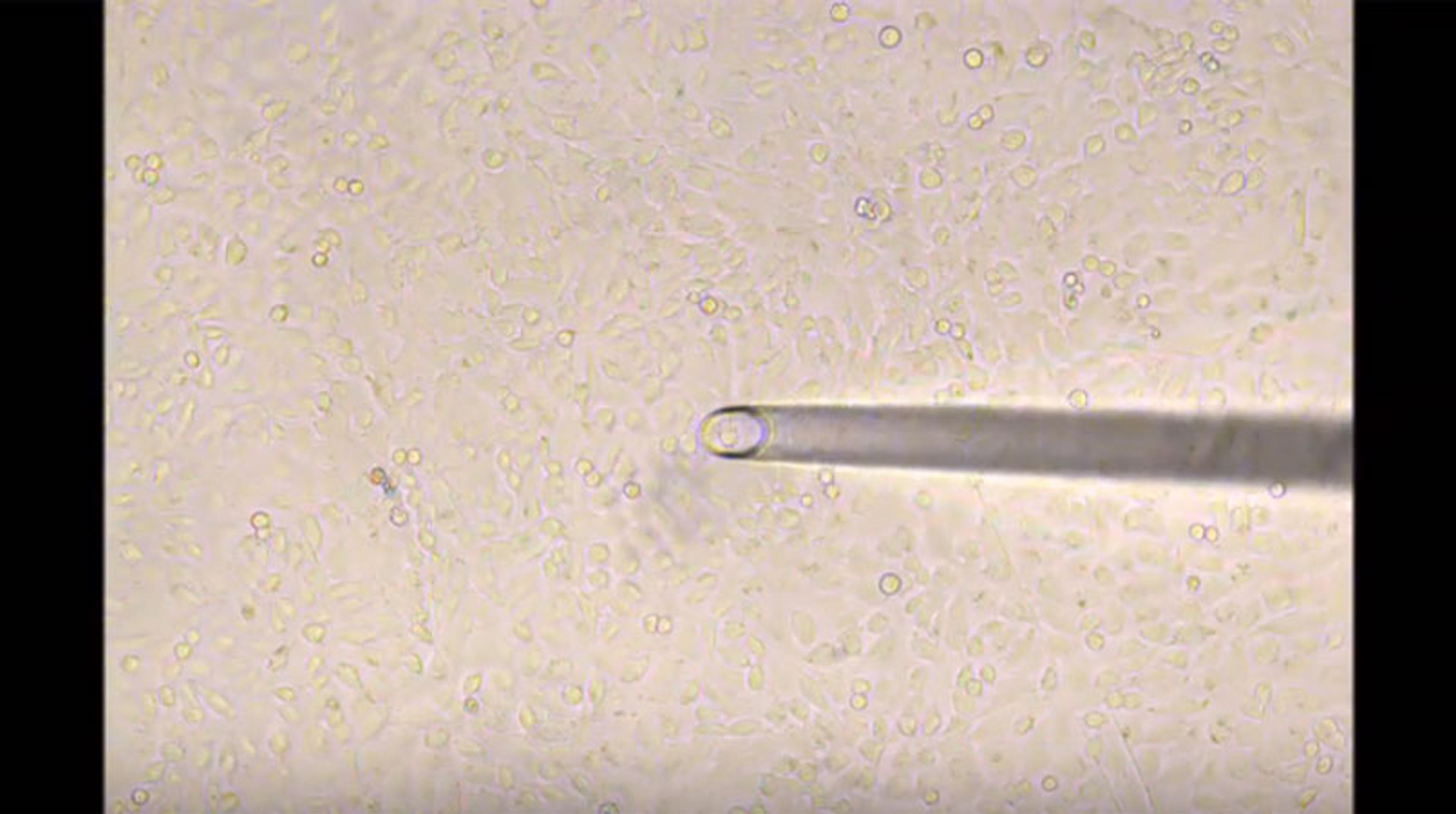 Isolating killer cells from a layer of HeLa cells Isolating killer cells from a layer of HeLa cells