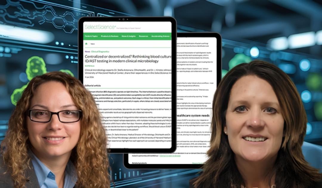 Transforming blood culture diagnostics: Finding the right model for modern labs