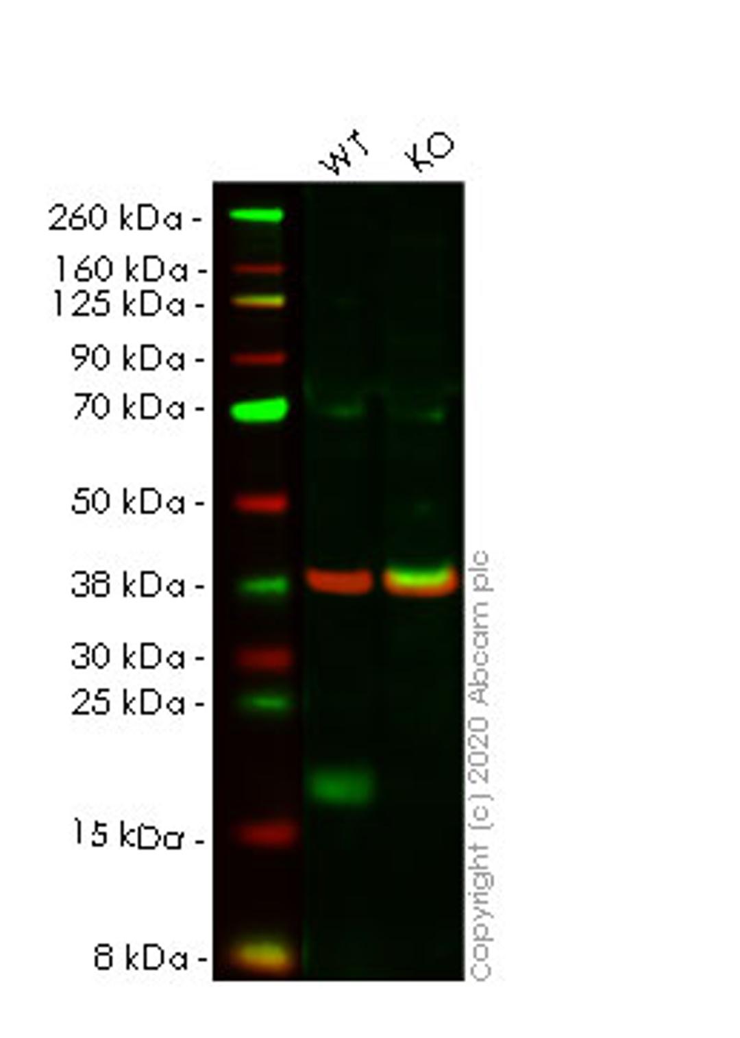 WB - EIF4EBP1 knockout HeLa